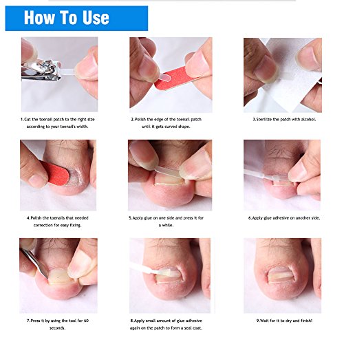 10pcs / kutija Uzgojena nokti za pedikuru, toenail korekcija naljepnica za patch za patch noa na noktima