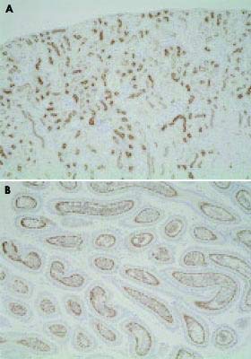 PAB14872-Veličina : 25 mikrograma - Anti-USP11 Poliklonsko antitijelo za zečeve - svaki