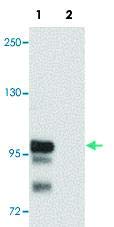 PAB19277-veličina : 100 mikrograma - Anti-SCUBE2 zečje Poliklonsko antitijelo - svaki